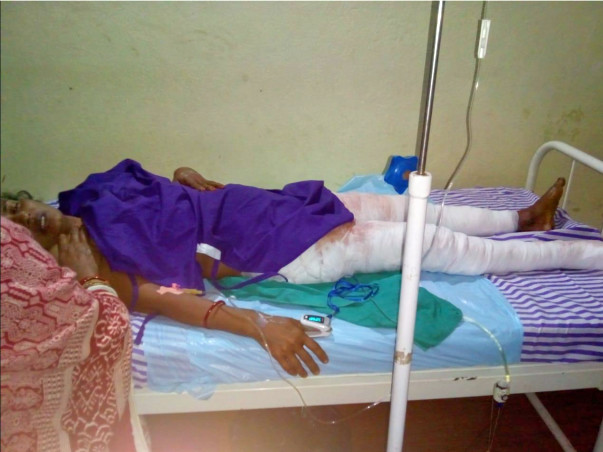 Help A Poor Burn Victim Recover