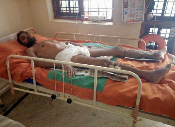 Help Bhanu fight full paralysis(neck-down) due to Spinal Cord fusion