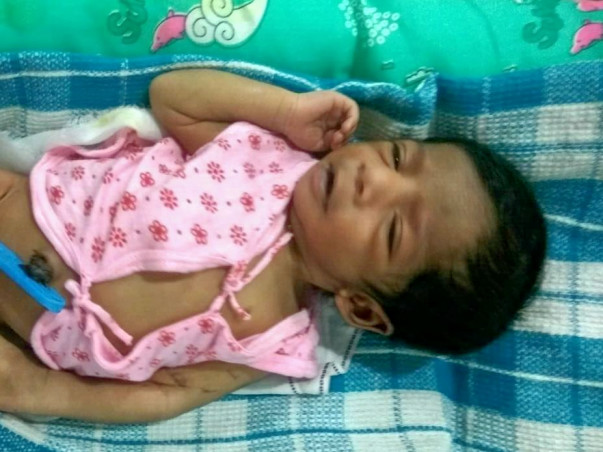 Kasthuri's baby fights for her life due to a severe heart disease