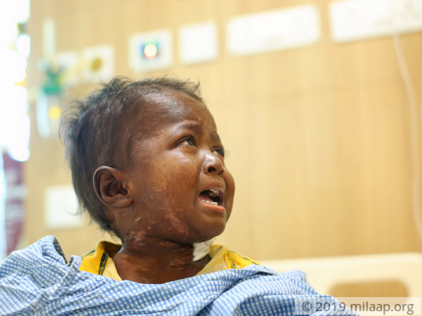2-year-old May Die Of Cancer Because He Does Not Have An Aadhar Card