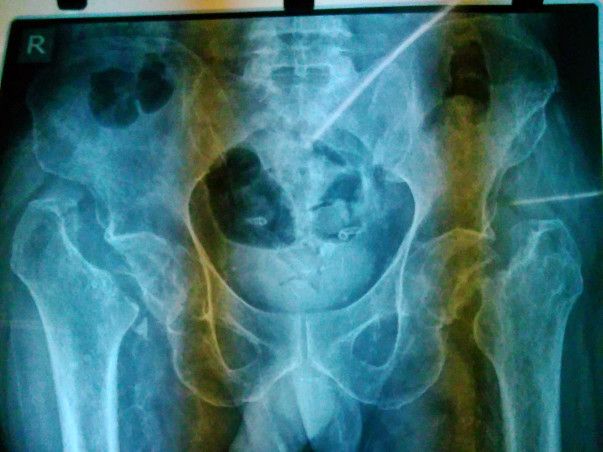 Help Me Get Back On My Feet