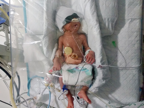Nilam's New-Born Twins Need Your Help Funding Their Treatment