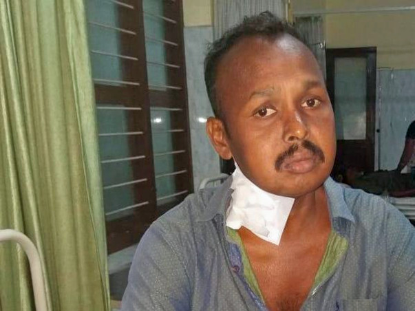 Help My Brother Undergo A Kidney Transplant