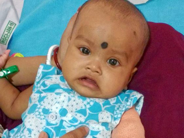 Help my 1-yr old niece undergo Bone Marrow Transplant to survive