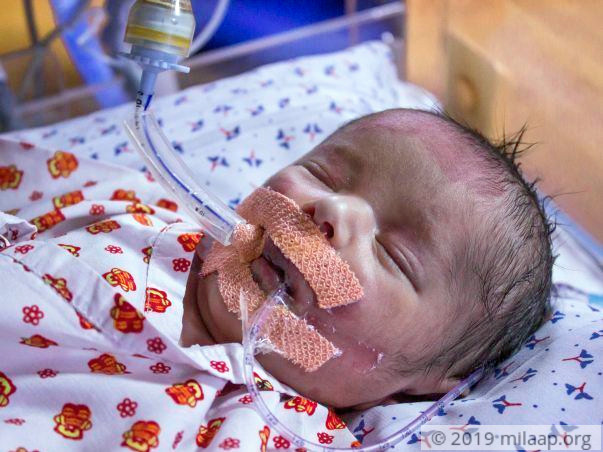 This Mother Is Distraught Over Saving Her 1-week-old Baby From Death