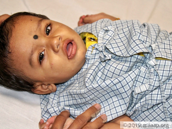 Baby Satvika needs your help to undergo treatment