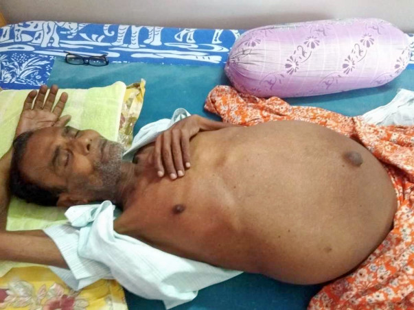 Help My Father Undergo A Liver Transplant