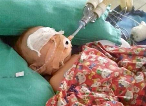 Help Snigdharaag Fighting Lung Infection and Spinal Chord Infections
