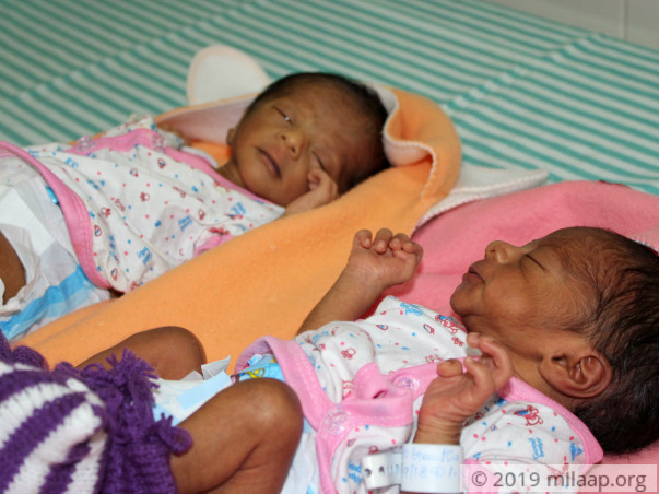 Even Their Parents’ Touch Can Be Fatal For These 15-Day-Old Twins