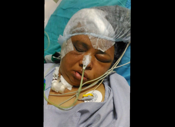 Help My Mother Alka To Fight Coma