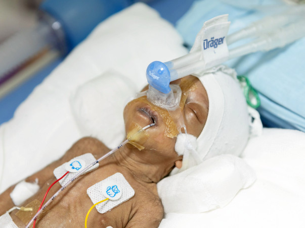 Severe Brain Infection Will Kill This 1-month-old Baby Girl