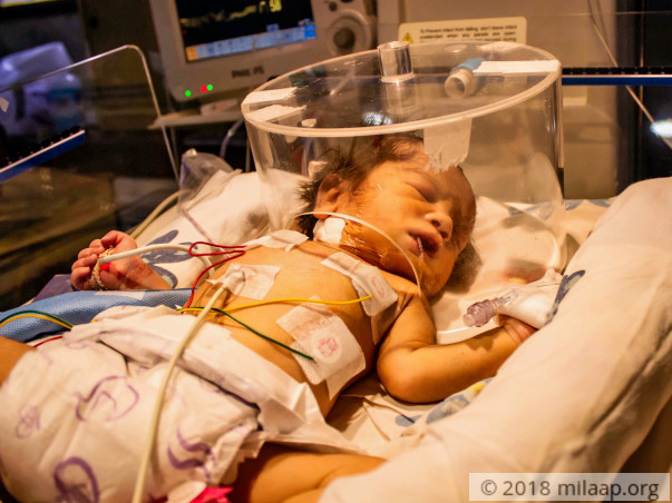 This 2-day-old's Intestines Are Pushing Into His Heart and Lungs