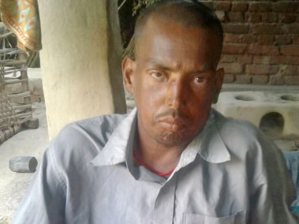 Help Pankaj (Pinku) Get Dialysis And Undergo Kidney Transplant