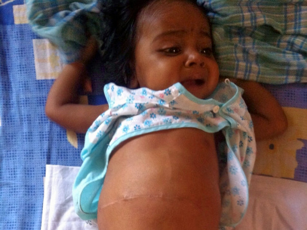 I am fundraising to buy book "Misha learns about money on Amazon to fund Baby Jhiya's treatment