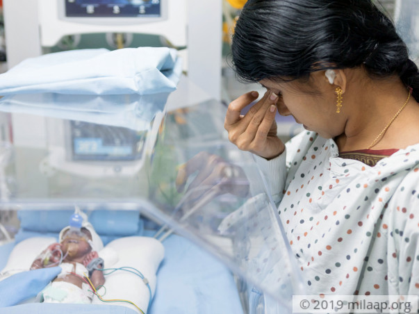 760 gram Baby Needs To Gain Weight To Survive His Premature Birth