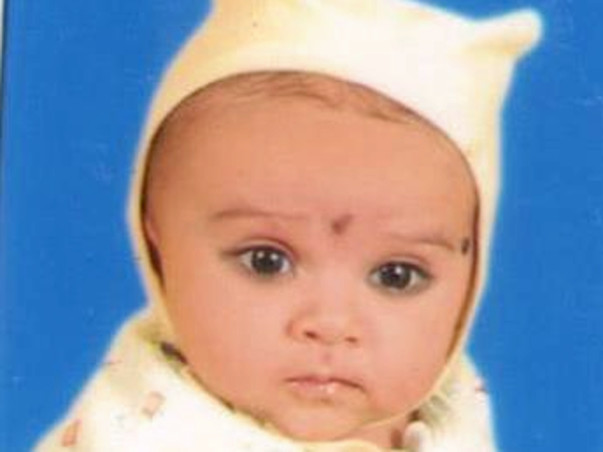 Help Baby Yashvi Undergo A Heart Operation