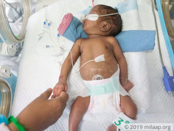 Help My Premature Baby Recover