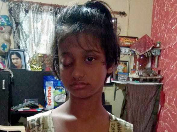 Help My Daughter Undergo Eye Cancer