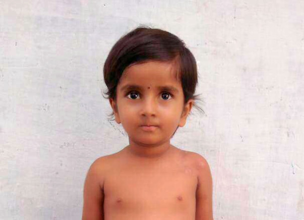 Help my daughter for liver transplantation