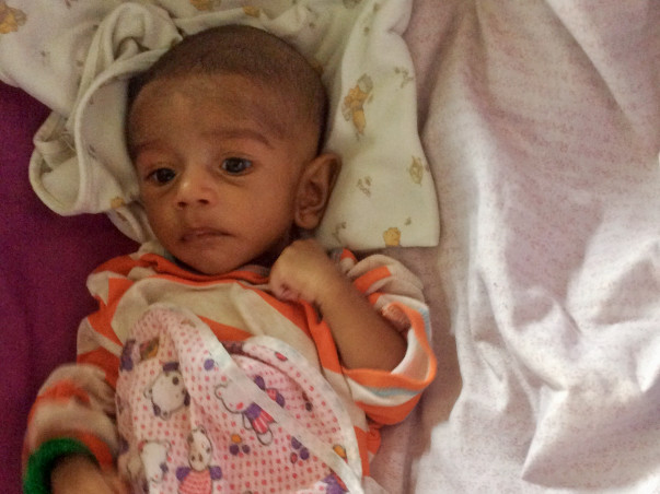 Please Help Me To Save My 3 Month Old Baby With 2 Holes In His Heart