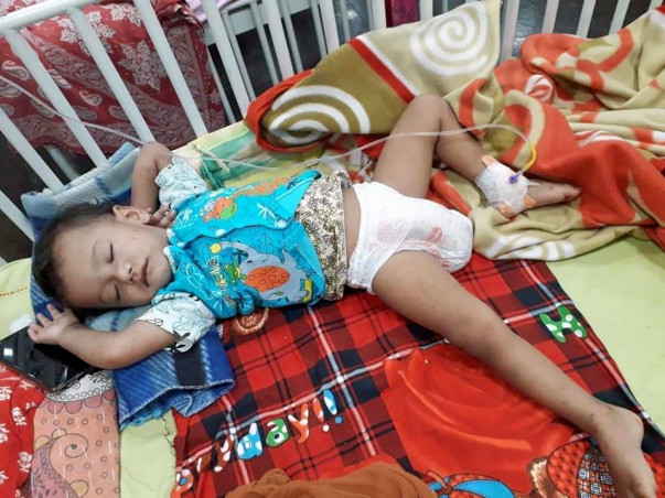 Help piku to bone marrow transplant