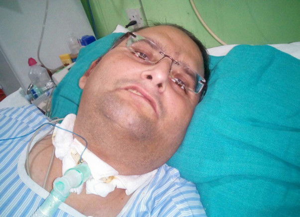 Save My BROTHER In Law