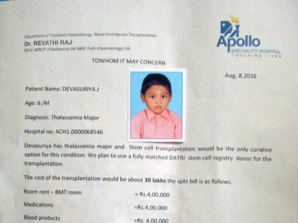 Child suffering from Thalassemia