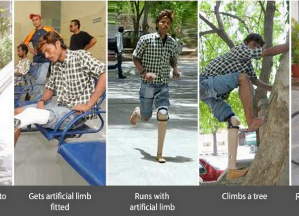 Fundraising to help Jaipur foot provide artificial limbs to 200 amputees. Support my project!