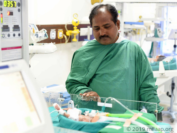 21-Day-Old Baby Girl Who Weighs Only 580 grams Needs Urgent Help