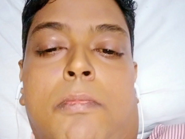Help mandip get a new liver and a new life
