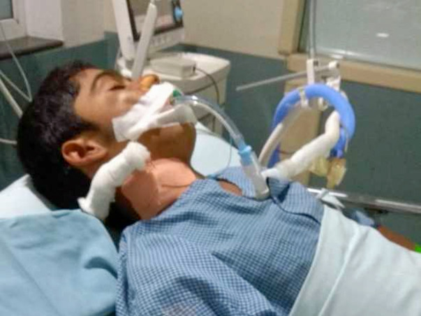 Need Help For Liver Transplatation