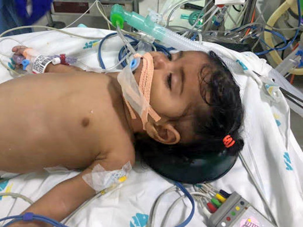5-month-old Anjali has only 49% Oxygen Level, Needs Heart Surgery