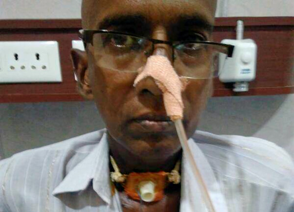 Help Narasa Reddy Afford Treatment for Throat Cancer