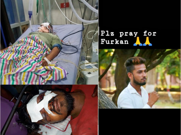 Help the Brother of an RTE student, who met with an accident!