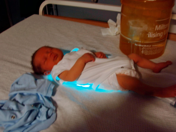 Help India fight Jaundice in Newborn