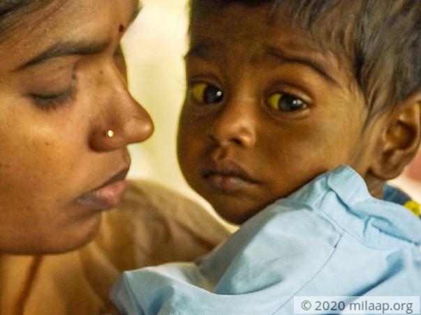 Help Guru Saran Recover From Decompensated Liver Cirrhosis