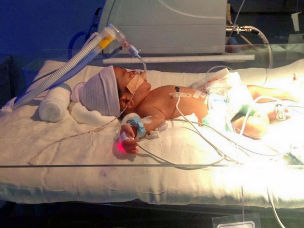 Help This 6-Day-Old Baby Stay Alive