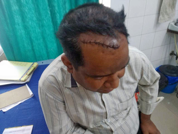 Help Pradeep Gangwa Recover From Accident