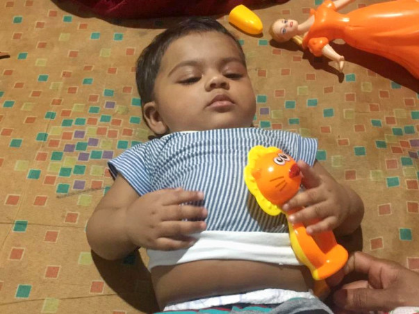 7 Months Old Baby Aira Needs Your Help To Recover From Liver disease