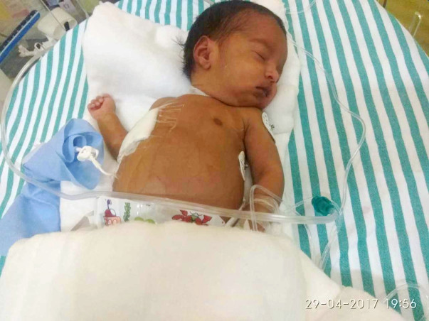 This Baby Developed Cancer A Week Before Her Birth