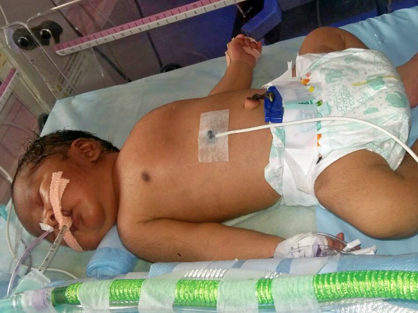 Save New Born Child Of Sankar Ramajayam Having Cardiac Issues
