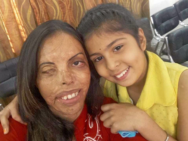 Help For Acid Attack Survivor And Her Family