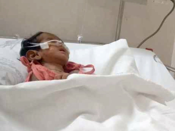2 Months Old Abinaya K Needs Your Help Fight Ventricular Septal Defect