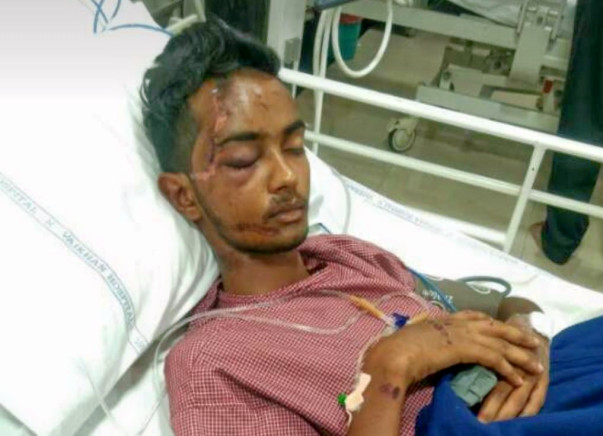 Need Money For A Friend's Skull fracture Operation