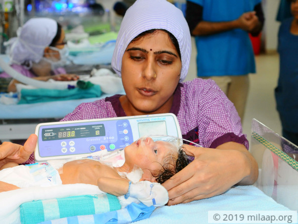 2-Month-Old Baby Still Struggling After 4 Surgeries