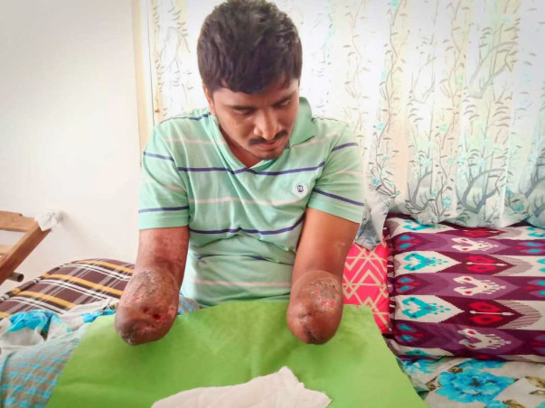 Help Vivek Get Back At Life!