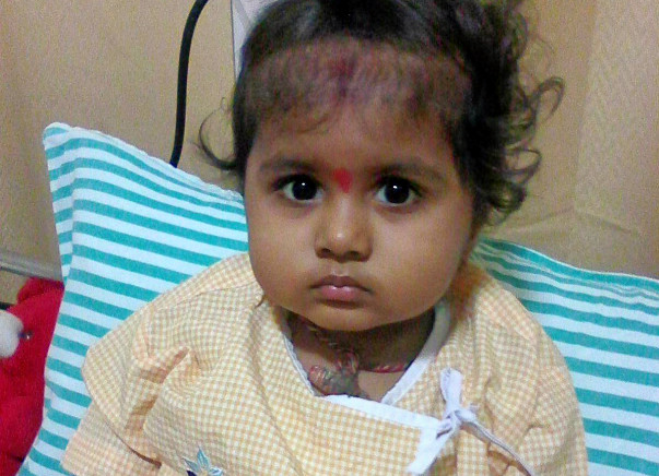 Baby Manvitha Needs Your Support To Fight Blood Cancer