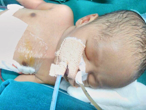 Baby Of Nazia Needs Your Help To Live