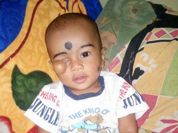 This 10-month-old's Survival Depends On An Open Heart Surgery