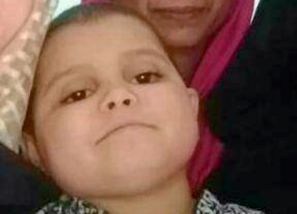 Help Ayesha Fight Suprasellar Meningioma